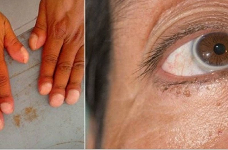 6 σημάδια καμπανάκια που δείχνουν πρόβλημα στην καρδιά!